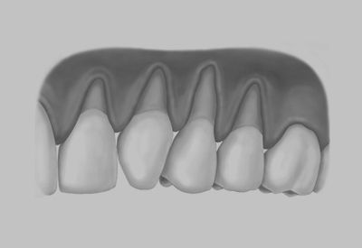 A black and white drawing of a set of teeth on a white background.