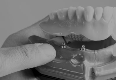 A black and white photo of a person holding a model of teeth.