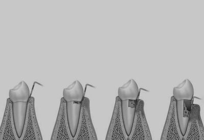 A black and white drawing of a row of teeth.