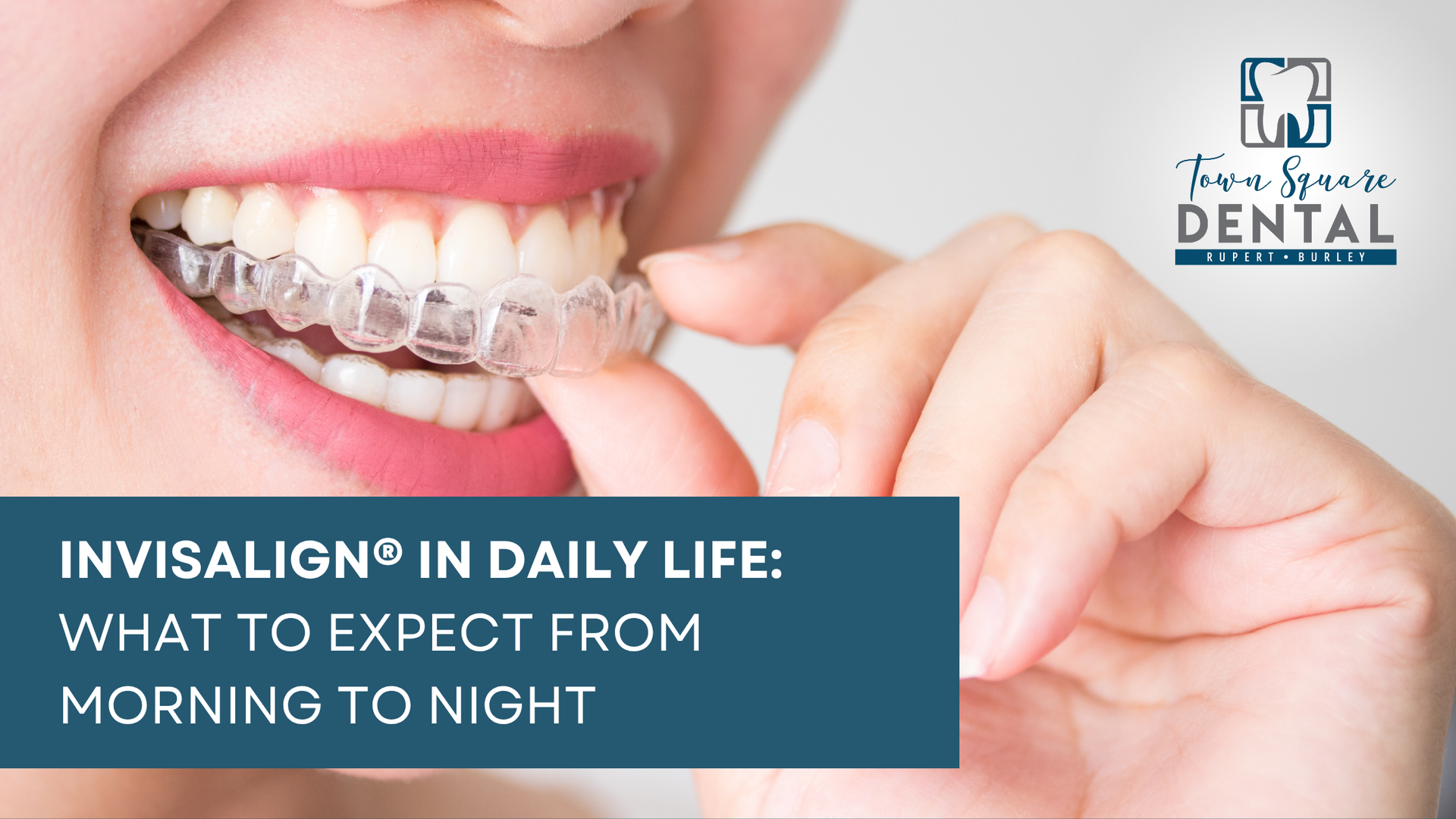 Woman inserting Invisalign aligner into her mouth, promoting the treatment's daily routine.