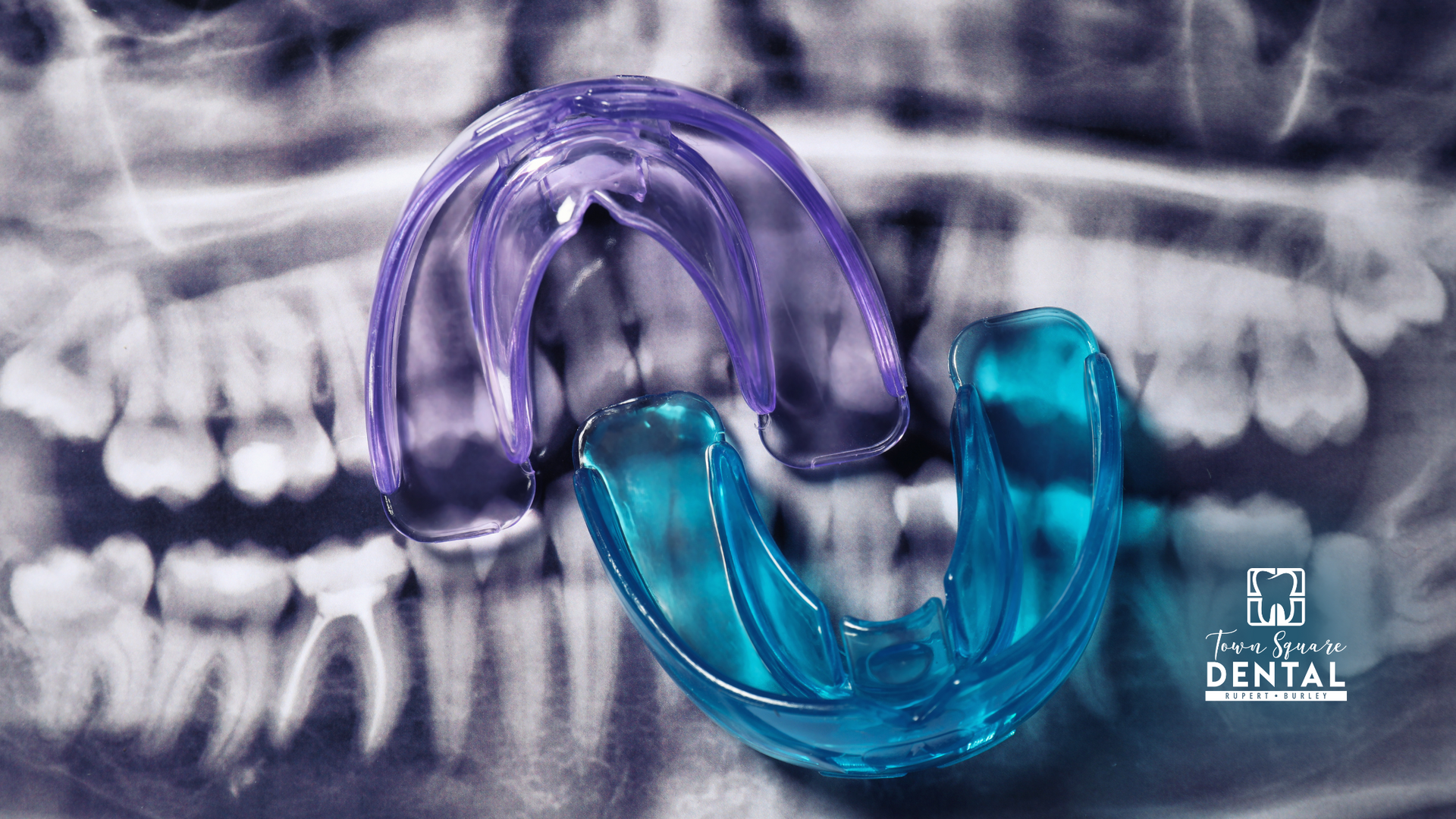 Two mouth guards are sitting on top of an x-ray of a person 's teeth.