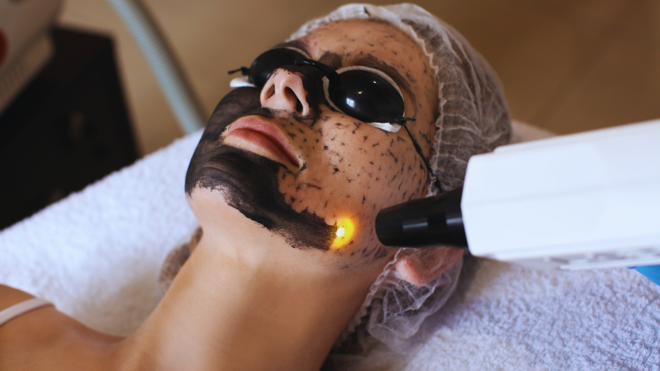 Person receiving laser facial treatment; a black mask covers face, laser device used in a medical spa setting.