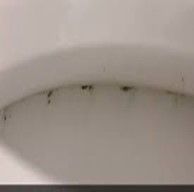Black Mold in Toilet Bowl