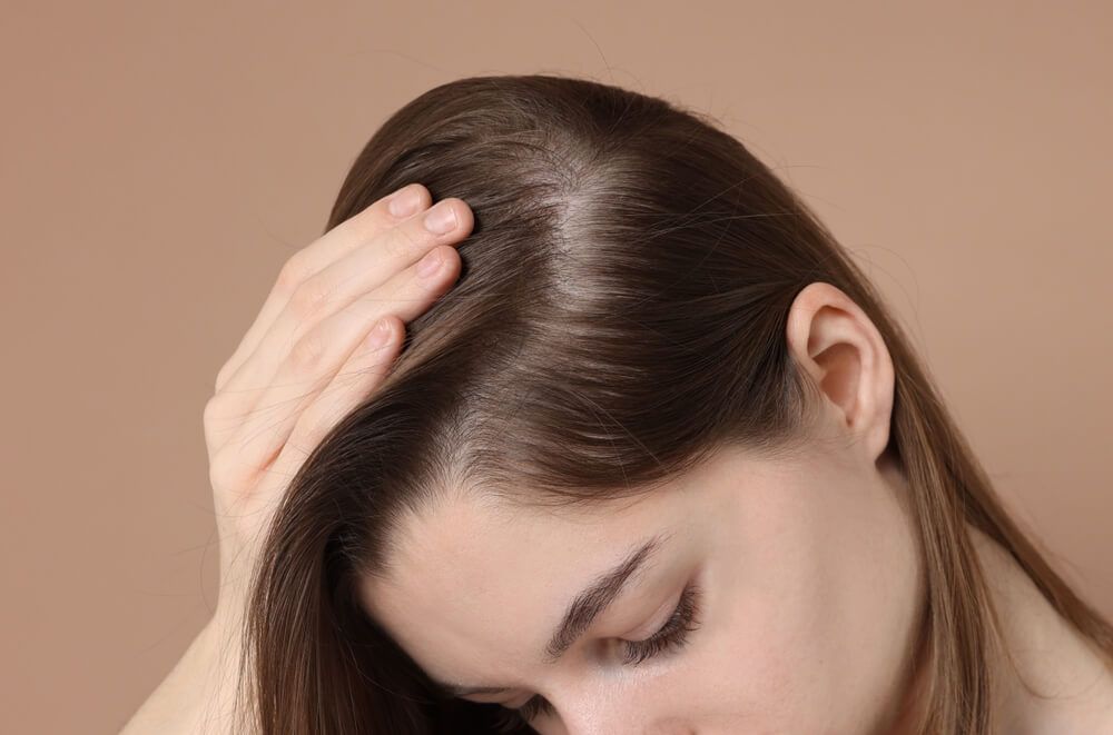 Woman touching her dark hair, showing scalp. Beige background.