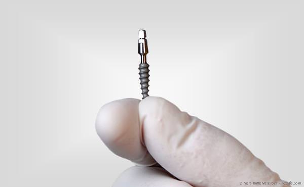 Mini-Implantat für schonende Behandlung