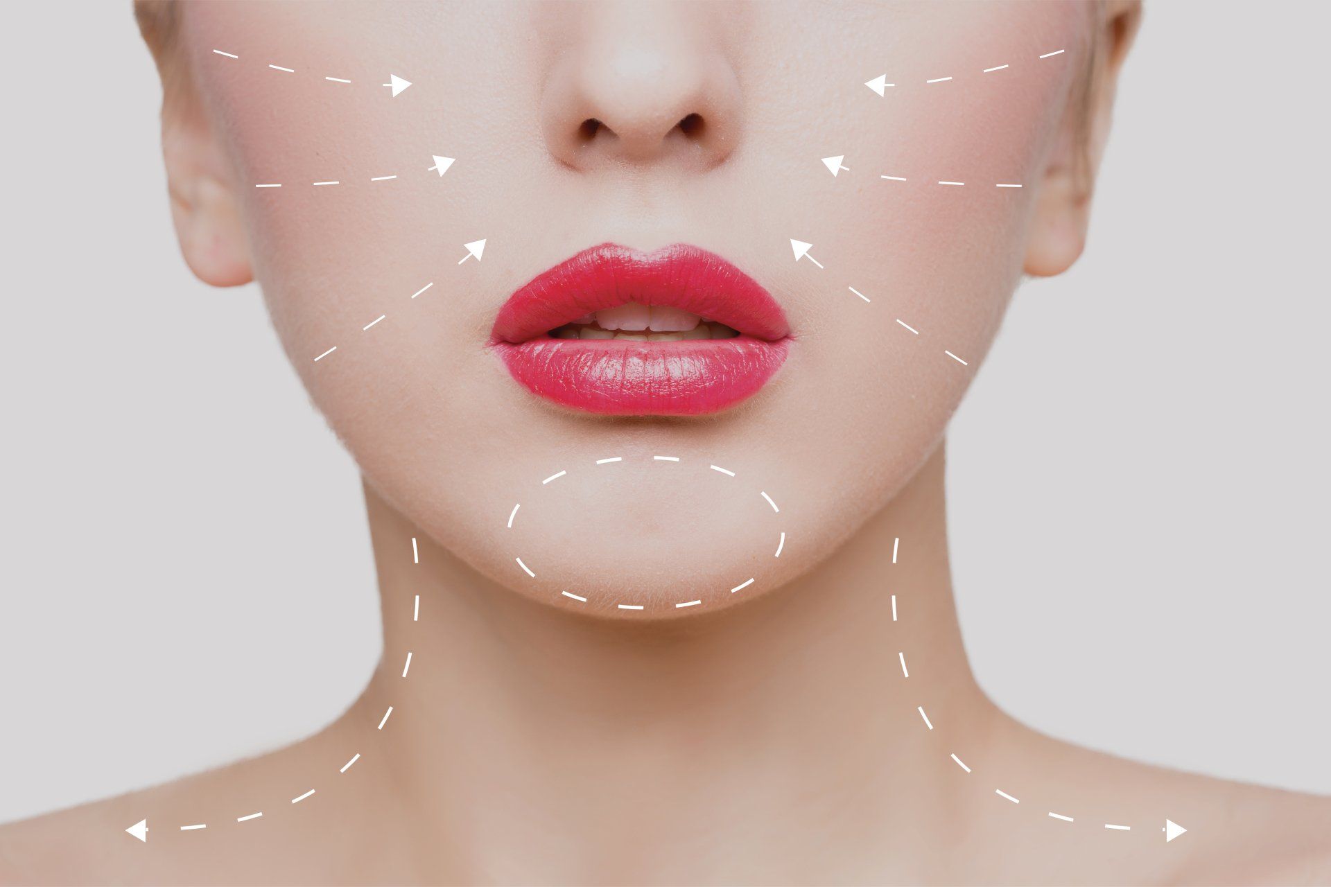 riduzione delle rughe