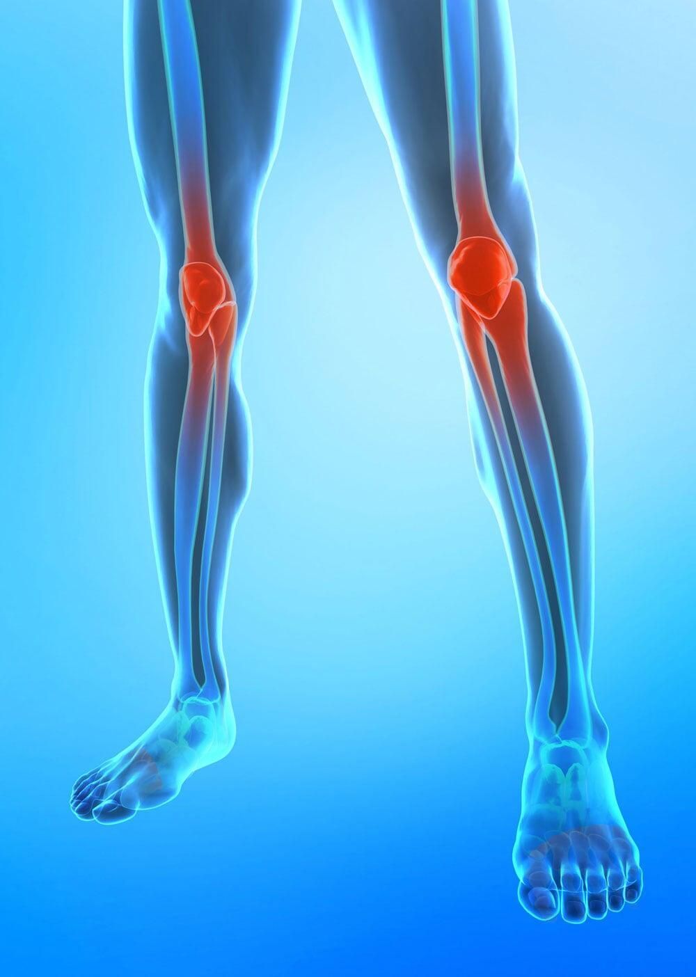 Piernas humanas azules con rodillas resaltadas en rojo, lo que indica dolor.
