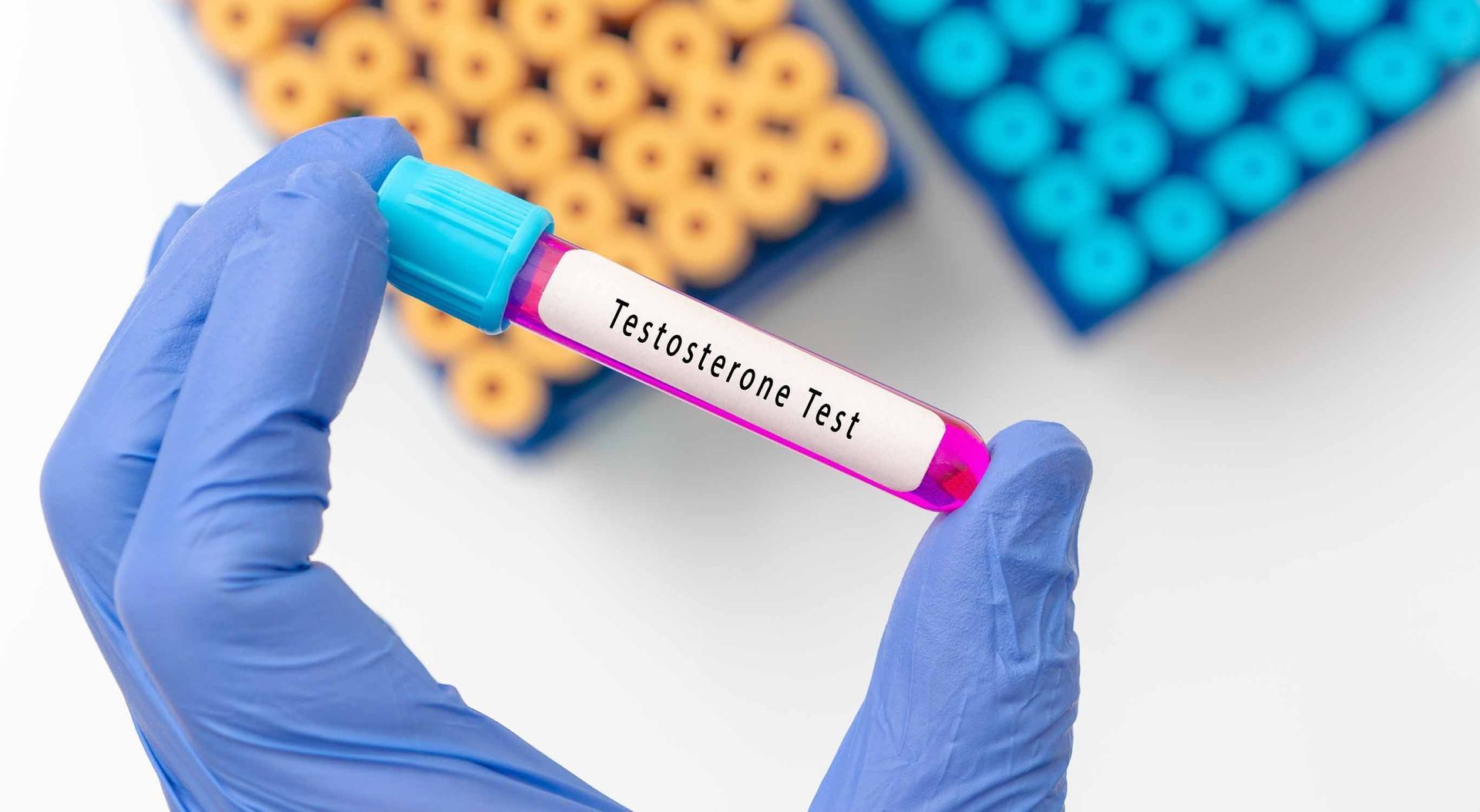 A person is holding a test tube with a label that says testosterone test.