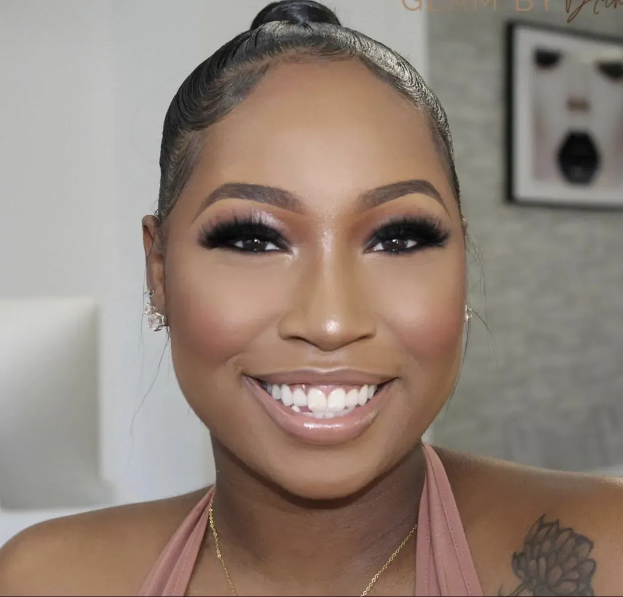 Halo Ali Teeth Whitening Photo