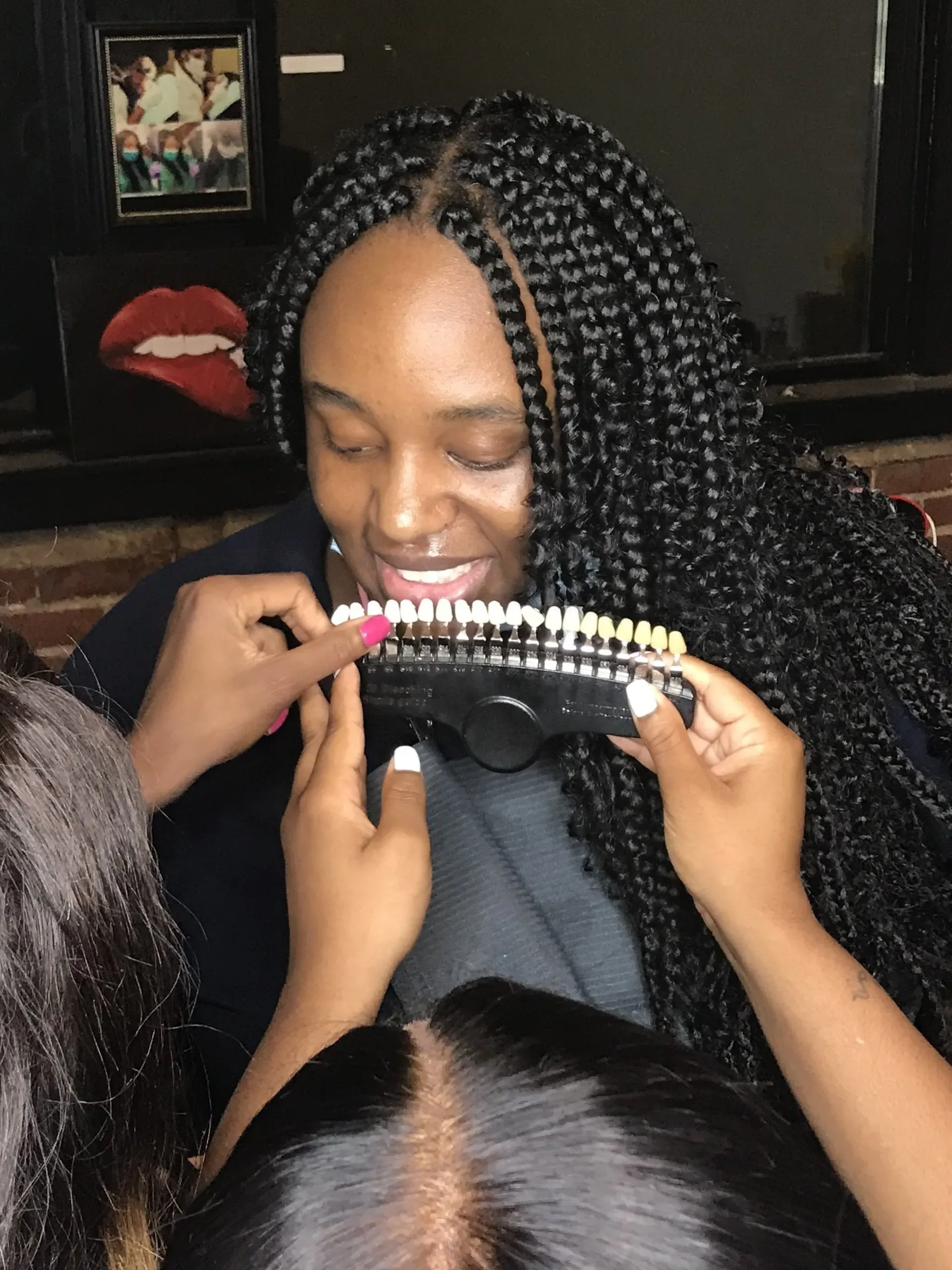 Halo Ali Teeth Whitening Photo