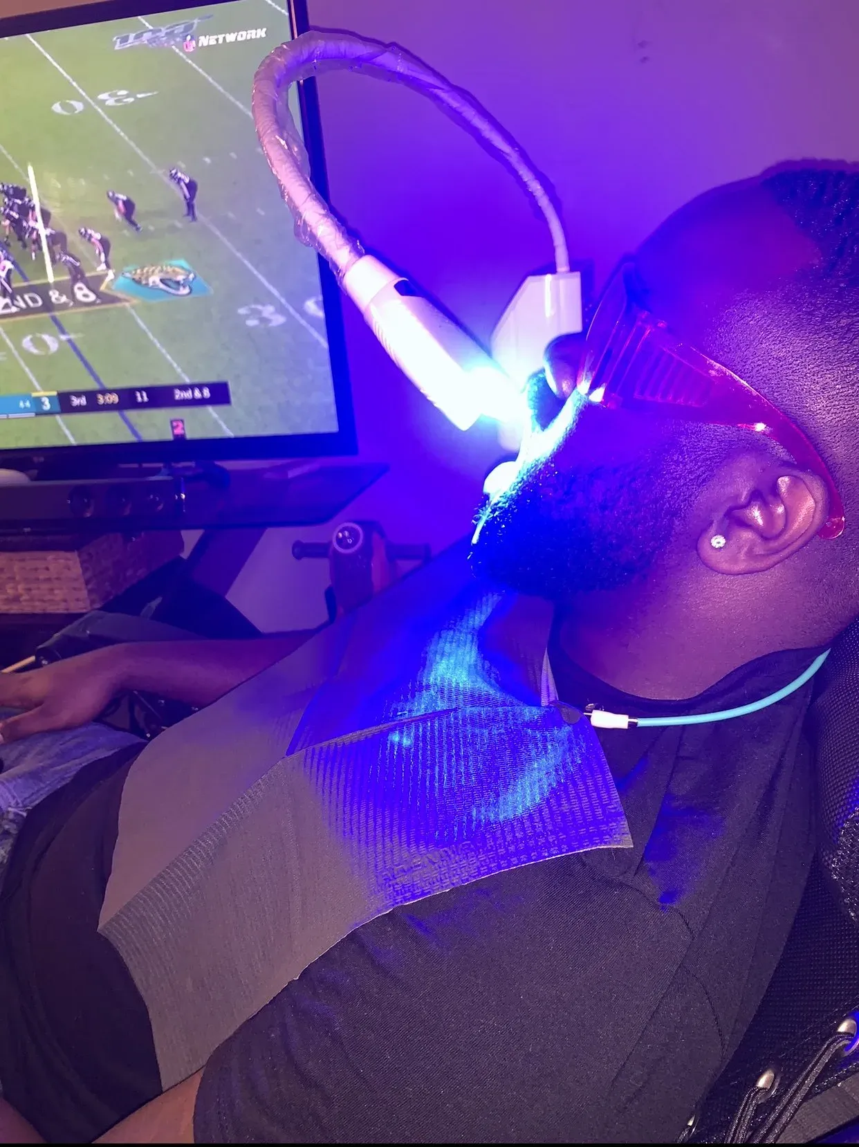 Teeth Whitening Services