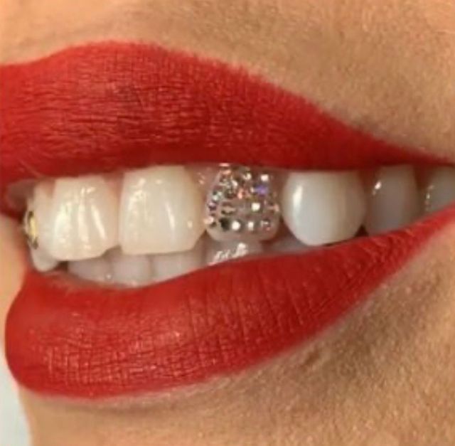 Professional Tooth Gem Kit & Training Course - Celebrity Whitening