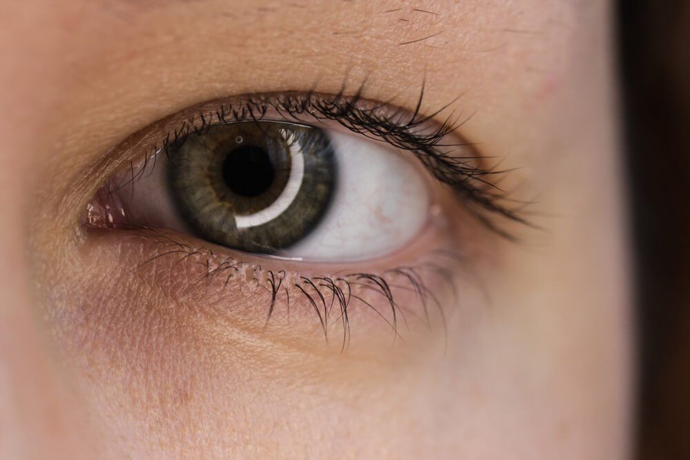 Eye with A Green Iris and A Spot — Your Ophthalmologist in Townsville, QLD