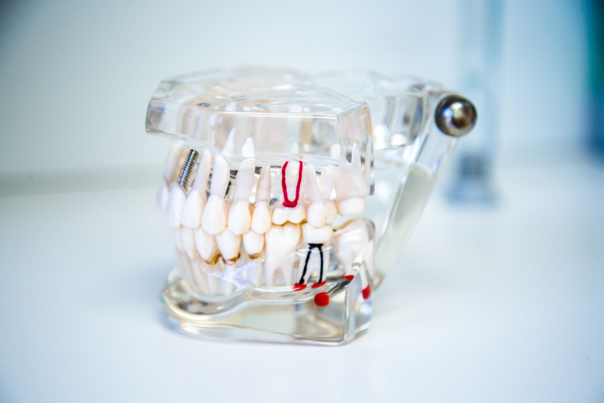 Clear plastic dental model of teeth, with red and black lines highlighting root canals on display.