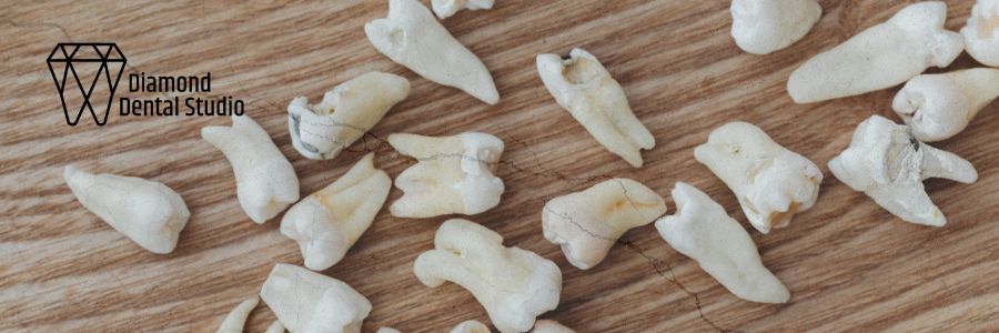 Scattered human teeth on a wooden surface, with a dental studio logo in the top left corner.