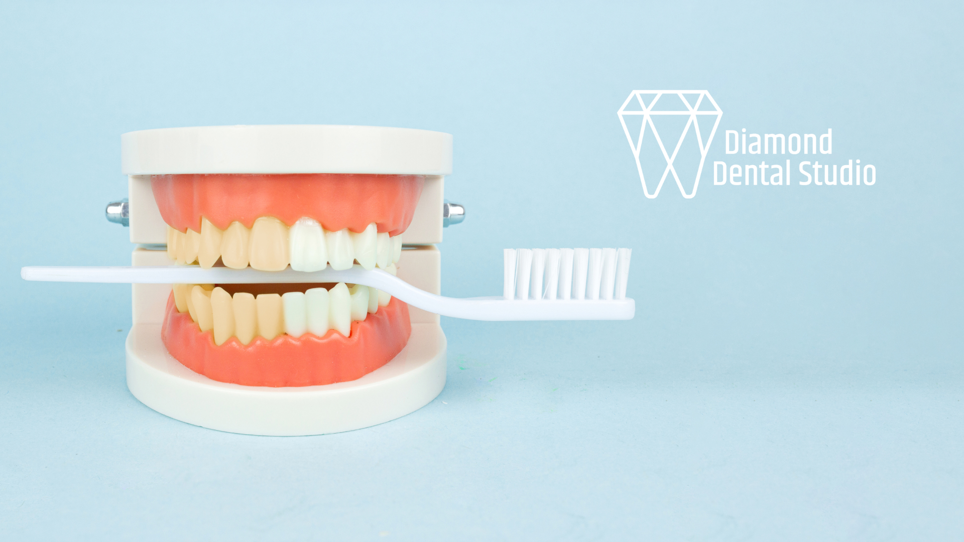Model teeth being brushed, showing the importance of oral hygiene.