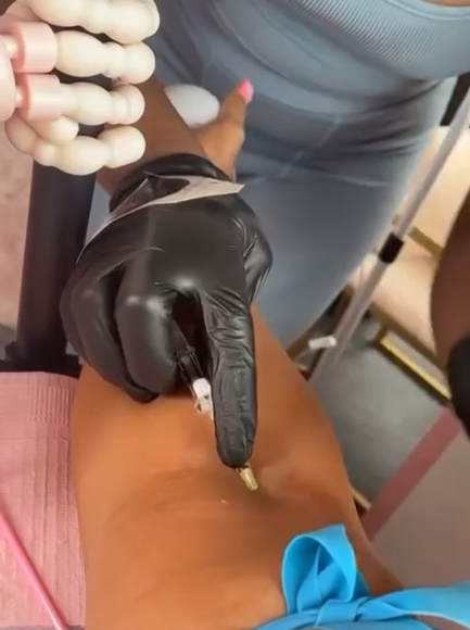 hand with needle mobile iv therapy from home urbanrx health lounge in houston, tx