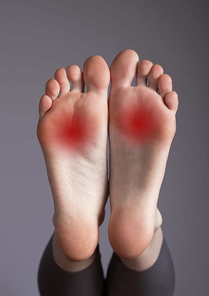 Neuromas