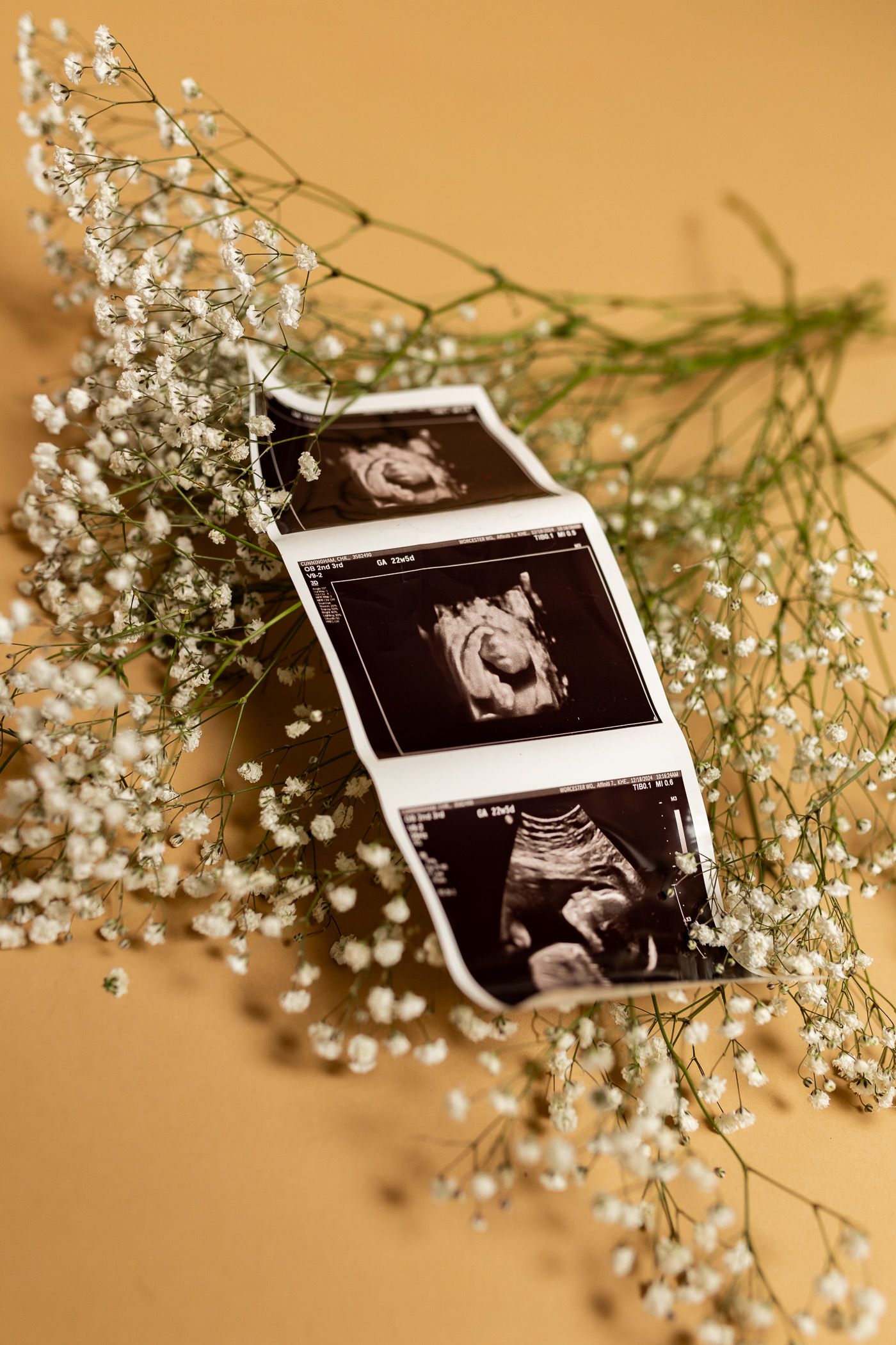 A beautiful mom to be in a white dress during her minimalistic maternity session