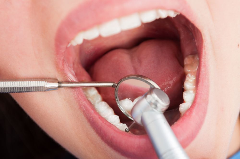 Open mouth with dental tools: mirror and drill, close up.