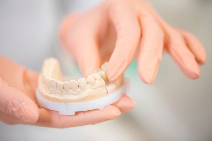 Una persona tiene in mano un modello di denti.