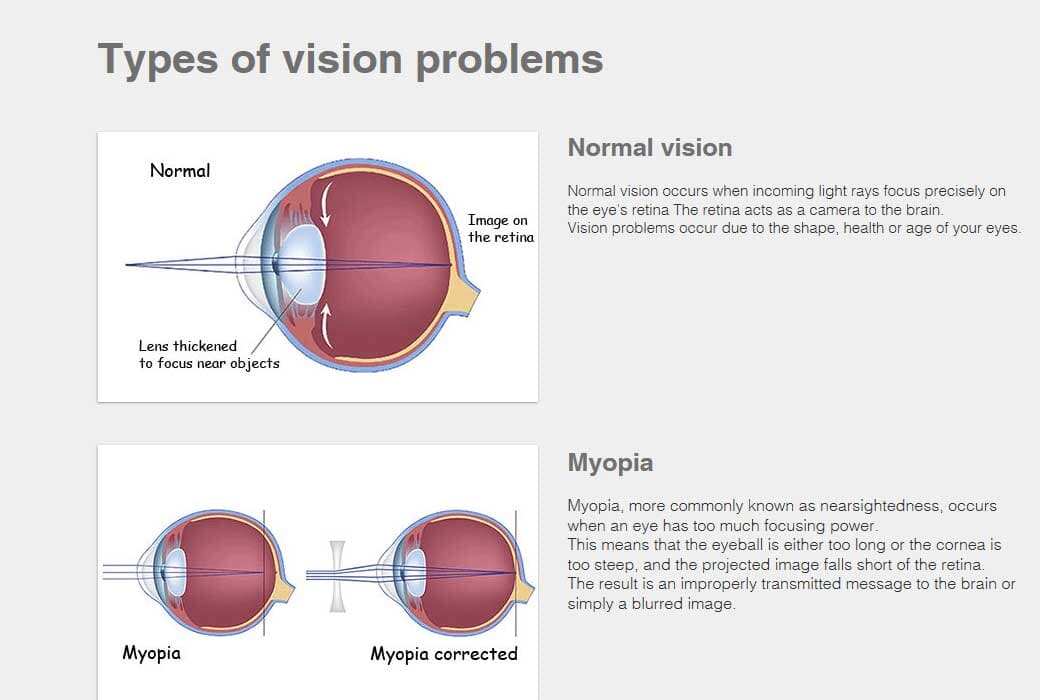 Types of vision problems - Eye Care in Barrington and Lake Zurich, IL