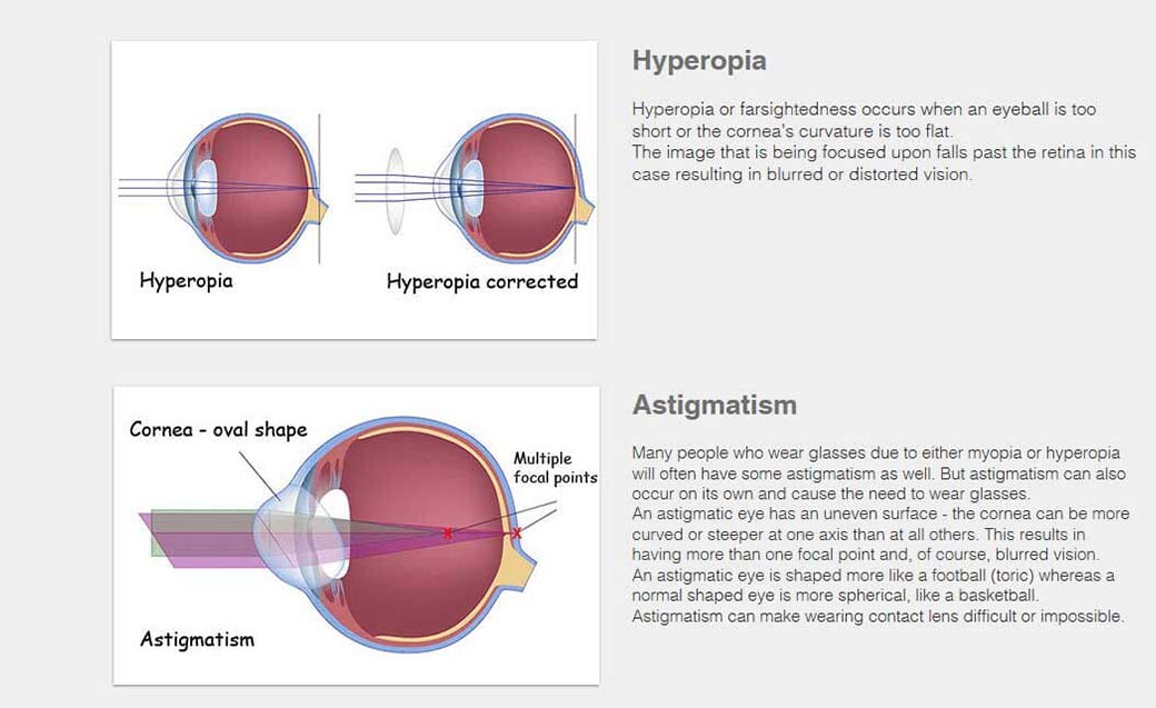 Hyperopia - Eye Care in Barrington and Lake Zurich, IL