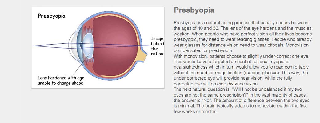 Presbyopia - Eye Care in Barrington and Lake Zurich, IL