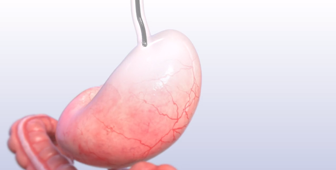 A person is holding a needle in their stomach.