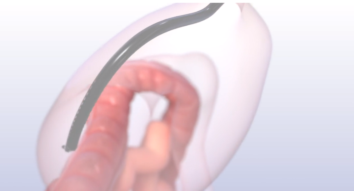 A close up of a person holding a balloon in their hand.