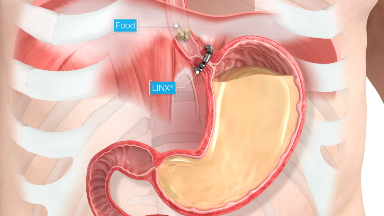 A computer generated image of a person 's stomach and chest.