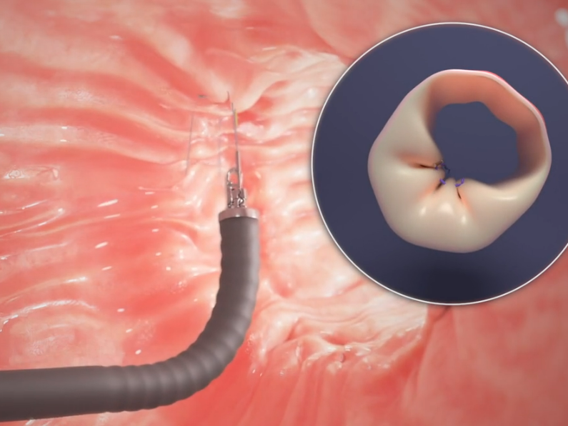 A picture of a heart with a needle in it