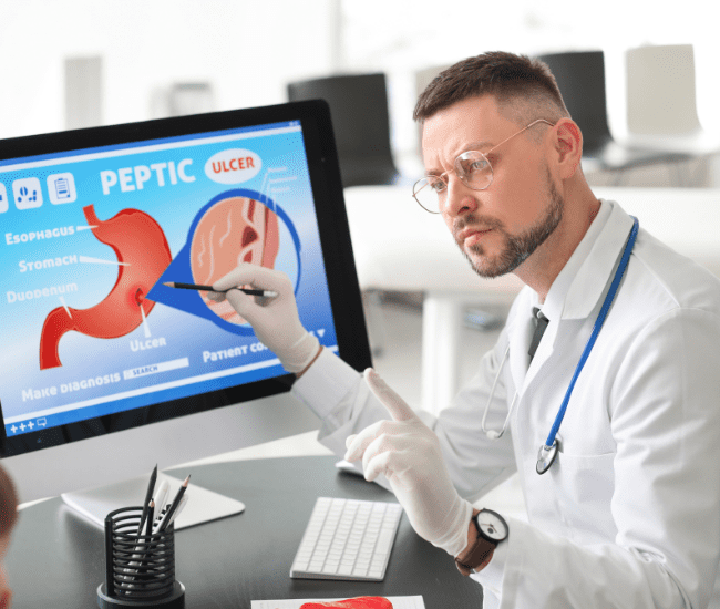 O médico aponta para a tela do computador, que mostra um diagrama de um estômago com úlcera péptica.