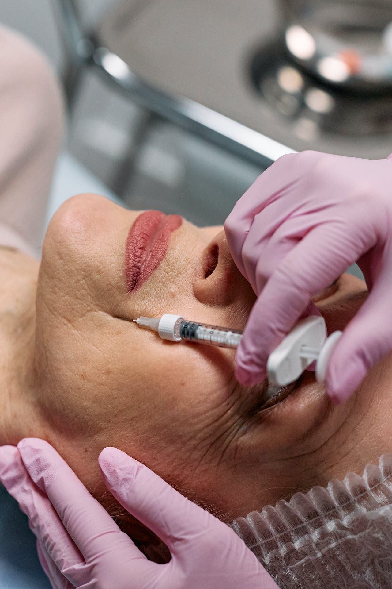 Chemical Peels Laser Hair Removal Services Skinja Medspa