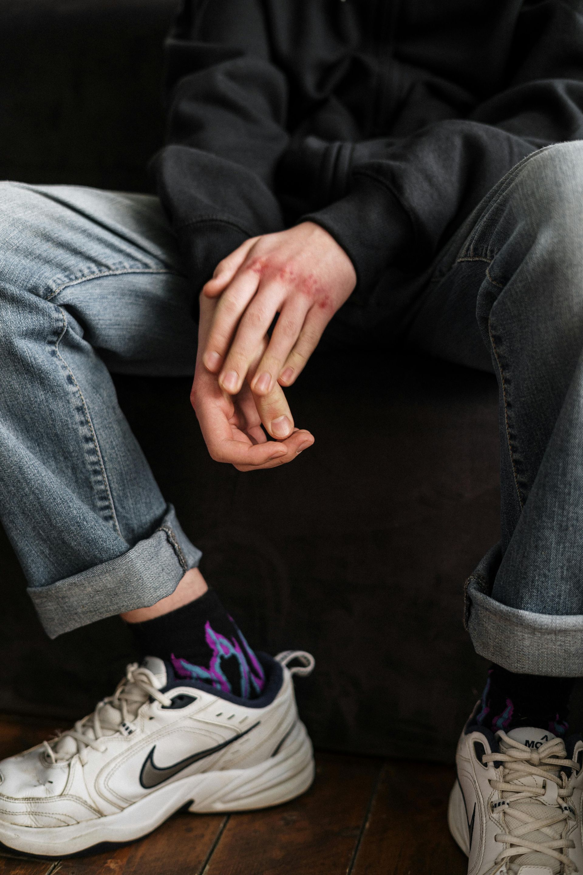 Person in jeans and a black hoodie sitting. White sneakers, colorful socks, hands in lap, and dark background. Seems to have pain and injury to right dominant hand.