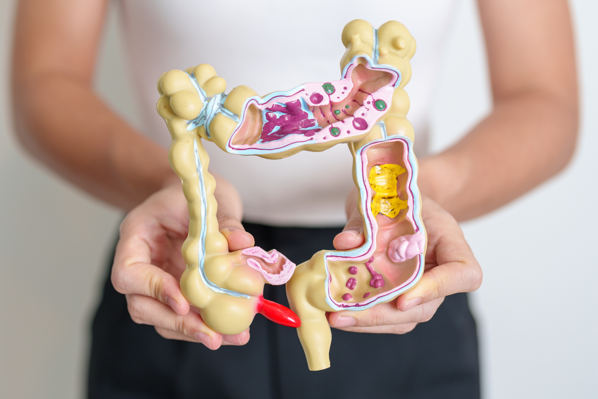 Person holding a model of a colon with visible sections and a red appendix.
