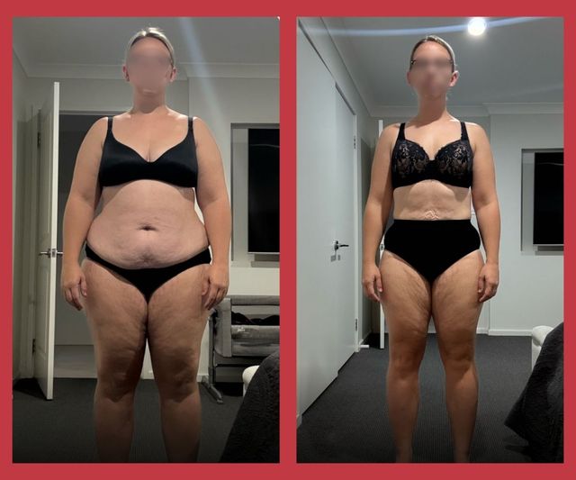 Side-by-side full-body mirror photos of a person in black lingerie before and after weight loss.