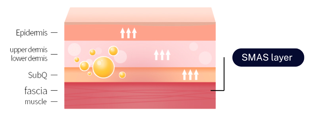 A close up of a shaver with an orange ring around it.