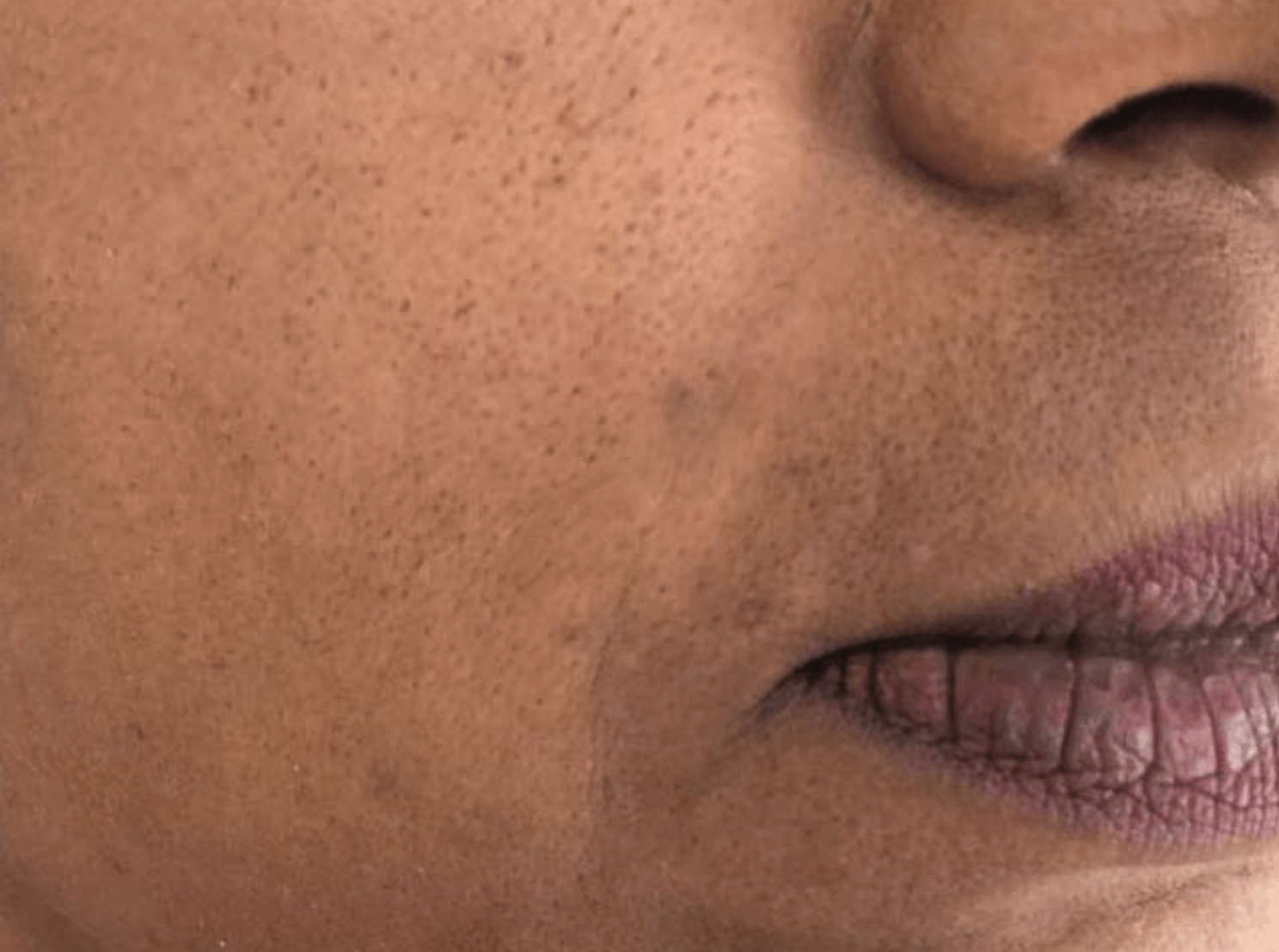 A close up of a woman 's face with freckles and pink lips.