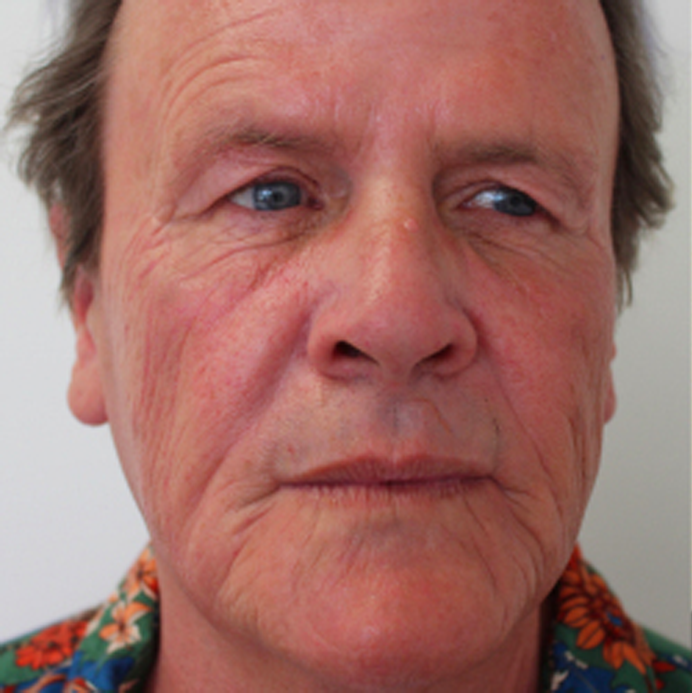 A close up of a man 's face with a floral shirt on