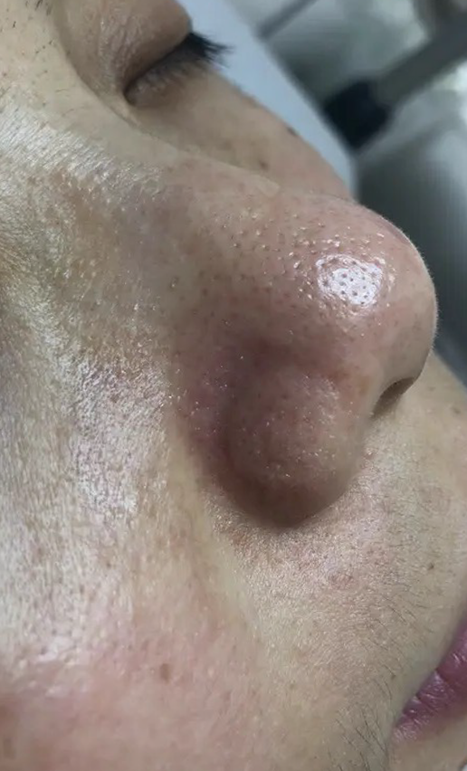 A close up of a woman 's nose with a red spot on it.