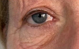 A close up of an elderly woman 's blue eye.