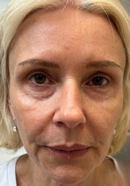 A close up of a woman 's face without makeup.