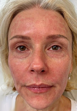 A close up of a woman 's face without makeup.