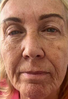 A close up of an older woman 's face with wrinkles.