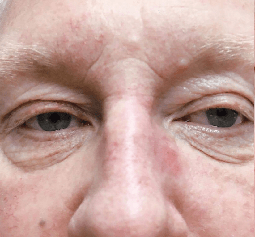 A close up of an older man 's eyes and nose.