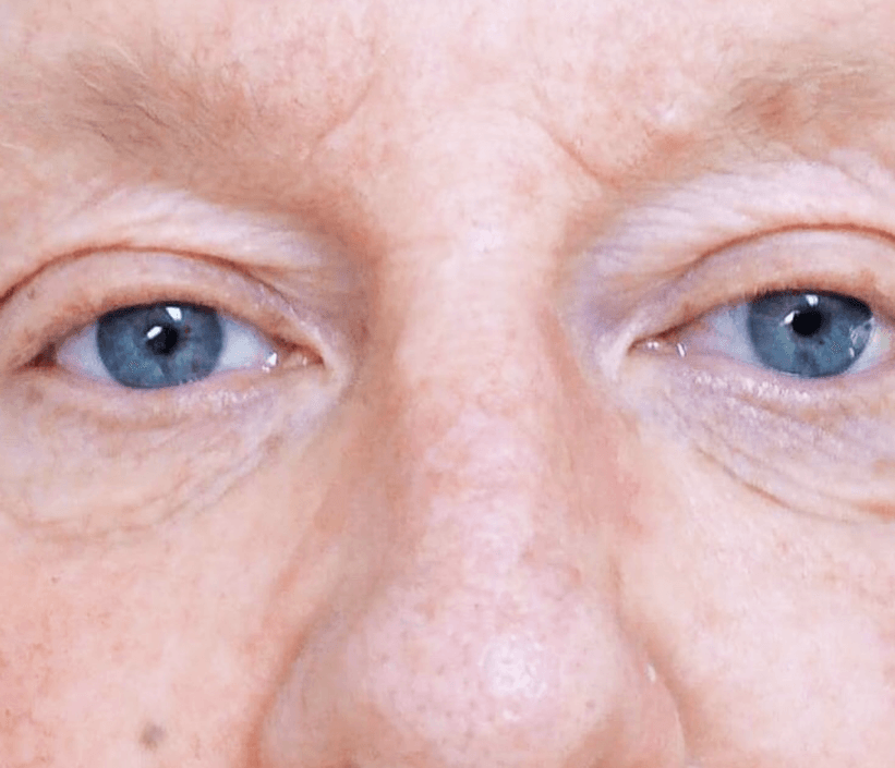 A close up of a person 's blue eyes and nose.