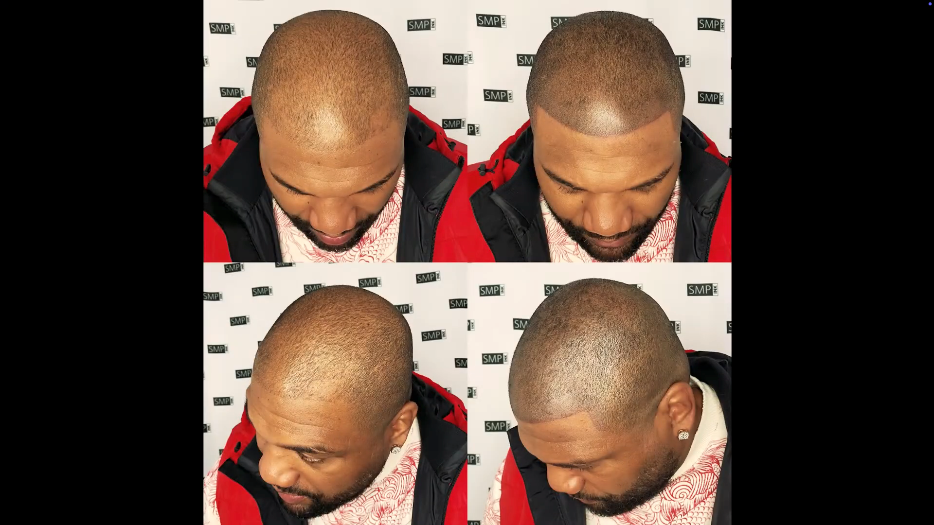 before and after rampage jackson's visit to SMP INK and receiving scalp micropigmentation