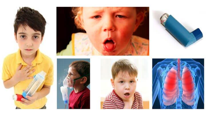 DR. RICARDO ÁLVAREZ VEGA - ASMA