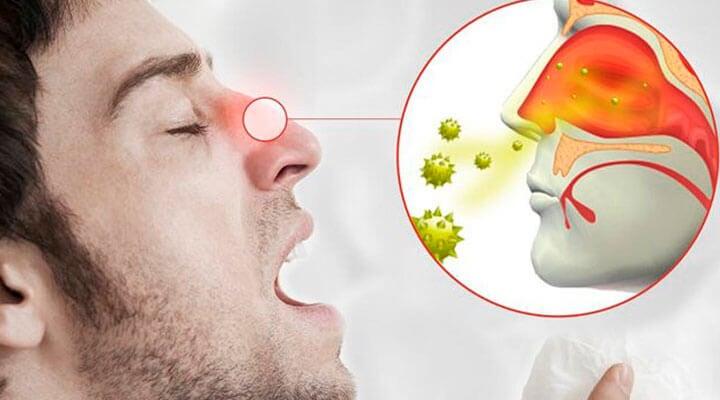 DR. RICARDO ÁLVAREZ VEGA - RIINITIS